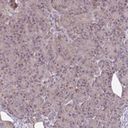 Immunohistochemical staining of human pancreas shows moderate cytoplasmic positivity in exocrine glandular cells.