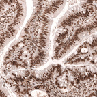 Anti-MSH2 Antibody