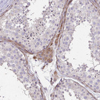 Anti-KIAA1161 Antibody