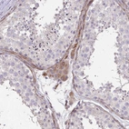 Immunohistochemical staining of human testis shows moderate cytoplasmic positivity in Leydig cells.