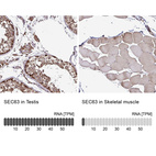 Anti-SEC63 Antibody