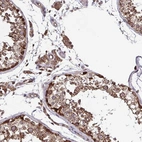 Immunohistochemical staining of human testis shows high expression.