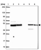 Lane 1: Marker [kDa] 250, 130, 95, 72, 55, 36, 28, 17, 10_br/_Lane 2: Human cell line RT-4_br/_Lane 3: Human cell line U-251MG sp_br/_Lane 4: Human plasma (IgG/HSA depleted)_br/_Lane 5: Human liver tissue_br/_Lane 6: Human tonsil tissue