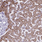 Anti-ANKRD60 Antibody