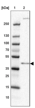 Lane 1: Marker [kDa] 250, 130, 100, 70, 55, 35, 25, 15, 10_br/_Lane 2: Human Testis tissue