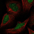 Anti-MLH3 Antibody