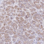 Anti-SIAH3 Antibody