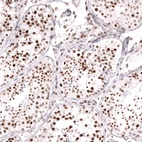 Immunohistochemical staining of human testis shows strong nuclear positivity in cells in seminiferous ducts.