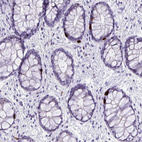 Immunohistochemical staining of human rectum shows strong cytoplasmic positivity in enteroendocrine cells.