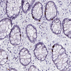 Anti-LCN15 Antibody