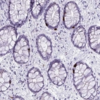 Immunohistochemical staining of human rectum shows strong cytoplasmic positivity in enteroendocrine cells.