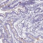 Immunohistochemical staining of human duodenum shows strong cytoplasmic positivity in enteroendocrine cells.