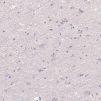 Immunohistochemical staining of human cerebral cortex shows no positivity in neurons as expected.