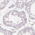 Immunohistochemical staining of human testis shows no positivity in cells in seminiferous ducts as expected.