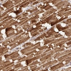 Immunohistochemical staining of human heart muscle shows strong cytoplasmic positivity in cardiomyocytes.