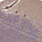 Immunohistochemical staining of human cerebellum shows strong nuclear positivity in Purkinje cells.