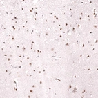 Immunohistochemical staining of human cerebral cortex shows moderate to strong nuclear positivity in neurons.