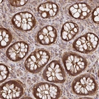 Immunohistochemical staining of human rectum shows moderate cytoplasmic positivity in glandular cells.