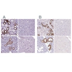 Immunohistochemical staining of human kidney, liver, salivary gland and skeletal muscle using Anti-BSND antibody HPA060617 (A) shows similar protein distribution across tissues to independent antibody HPA053836 (B).