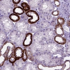 Immunohistochemical staining of human kidney shows moderate to strong membranous positivity in cells in tubules.