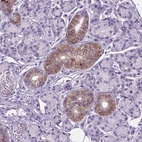 Immunohistochemical staining of human salivary gland shows moderate membranous positivity in ductal cells.