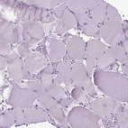 Immunohistochemical staining of human skeletal muscle shows no positivity in myocytes as expected.