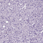 Immunohistochemical staining of human liver shows no positivity in hepatocytes as expected.
