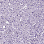 Anti-BSND Antibody