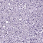Immunohistochemical staining of human liver shows no positivity in hepatocytes as expected.