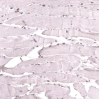 Immunohistochemical staining of human skeletal muscle shows no positivity in myocytes as expected.
