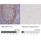 Anti-TIMELESS Antibody