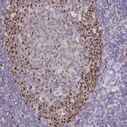 Immunohistochemical staining of human tonsil shows strong nuclear positivity in germinal center cells.