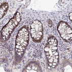 Immunohistochemical staining of human colon shows strong nuclear positivity in glandular cells.