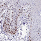 Immunohistochemical staining of human skin shows moderate nuclear positivity in a subset of squamous epithelial cells.
