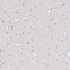 Immunohistochemical staining of human cerebral cortex shows no positivity in neurons as expected.