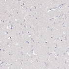 Immunohistochemical staining of human cerebral cortex shows no positivity in neurons as expected.