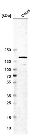 Western blot analysis in human cell line Daudi.