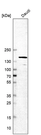 Western blot analysis in human cell line Daudi.