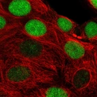 Immunofluorescent staining of human cell line MCF7 shows localization to nucleus.