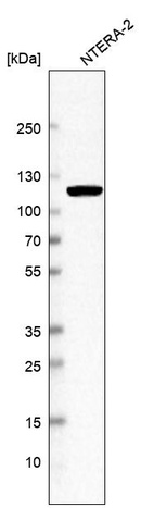 Anti-MSH2 Antibody