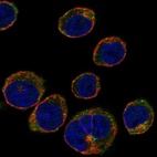 Immunofluorescent staining of human cell line HEL shows localization to cytosol & vesicles.