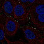 Immunofluorescent staining of human cell line HaCaT shows localization to cell junctions.
