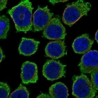 Immunofluorescent staining of human cell line HEL shows localization to cytosol.