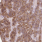 Immunohistochemical staining of human parathyroid gland shows high expression.