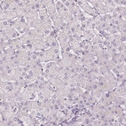 Immunohistochemical staining of human liver shows low expression as expected.