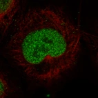 Immunofluorescence staining in NTERA-2 cell line with Anti-MSH2 monoclonal antibody, showing specific staining of nucleoplasm in green. Microtubule- and nuclear probes are visualized in red and blue respectively (where available).