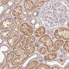 Anti-RAB11A Antibody