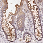 Immunohistochemical staining of human colon shows moderate positivity in glandular cells.