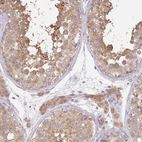 Immunohistochemical staining of human testis shows weak to moderate cytoplasmic positivity in cells in seminiferous ducts.