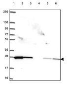 Lane 1: Marker [kDa] 250, 130, 95, 72, 55, 36, 28, 17, 10_br/_Lane 2: Human cell line RT-4_br/_Lane 3: Human cell line U-251 MG_br/_Lane 4: Human plasma_br/_Lane 5: Human Liver tissue_br/_Lane 6: Human Tonsil tissue